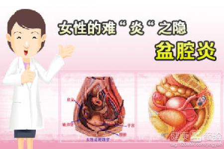 邳州同健医院讲盆腔炎危害
